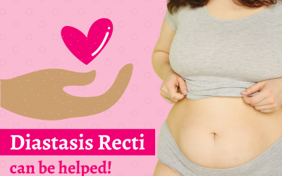 Diastasis Recti can be helped!