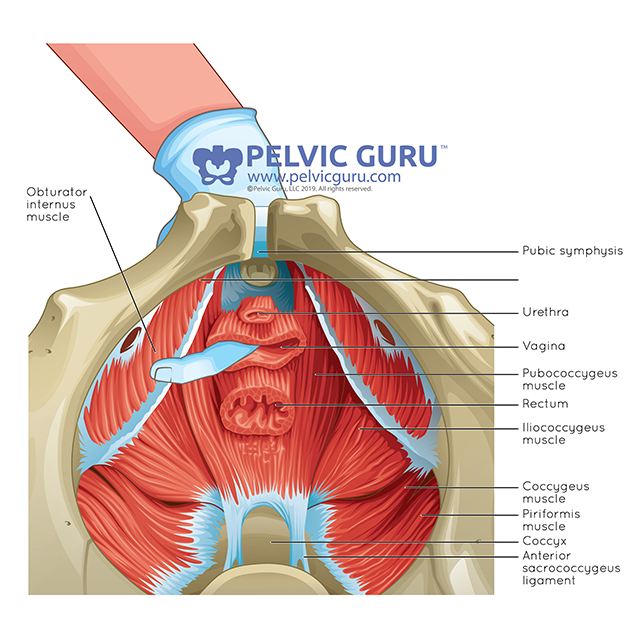 Hypertonic Pelvic Floor Dysfunction And Pregnancy